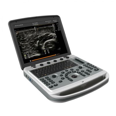 Chison SonoTouch 80 Pro