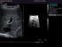 Siemens Acuson S2000