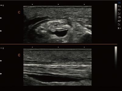 Chison SonoTouch 80 Exp