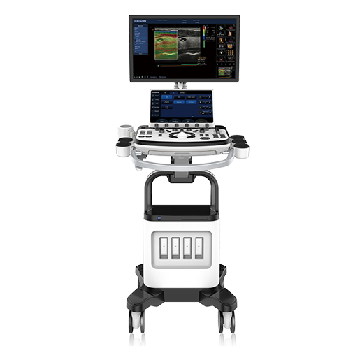 Chison XBit 80