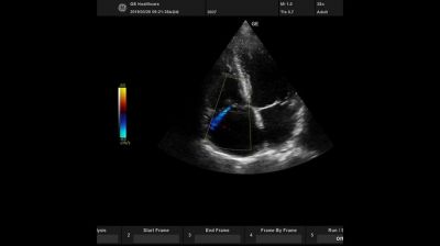 GE Healthcare Versana Active