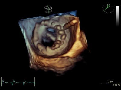 GE Healthcare Vivid S70