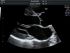 GE Healthcare Voluson P6