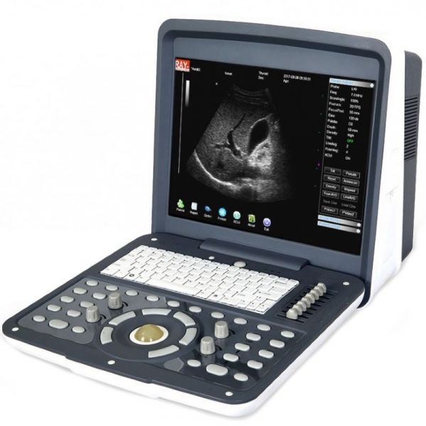 Acuvista RS880d 15"