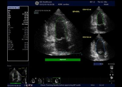 GE Healthcare Logiq F8