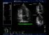 GE Healthcare Logiq F8