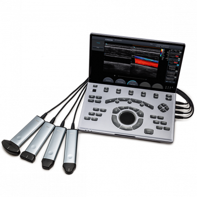 Chison SonoTouch 50 (SonoAir)