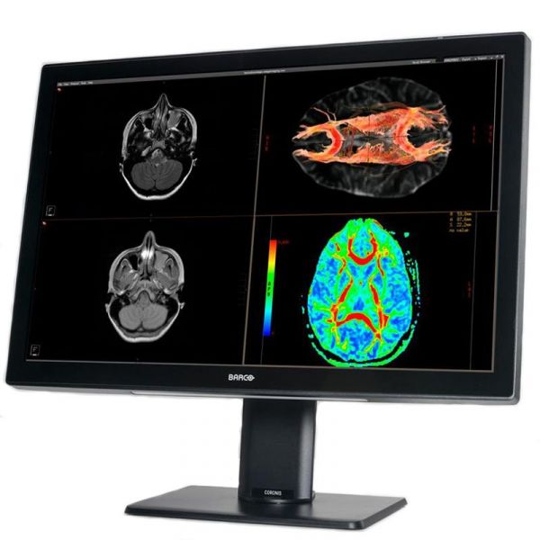 Barco Coronis Fusion 6MP MDCC-6530