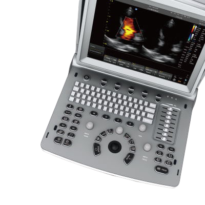 Chison SonoTouch 50