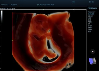 Mindray Resona 7s