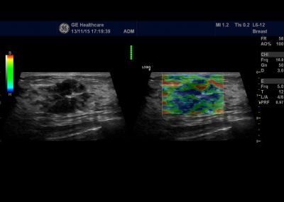 GE Healthcare Logiq F6