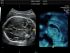 GE Healthcare Voluson P8