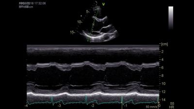 GE Healthcare Vivid IQ