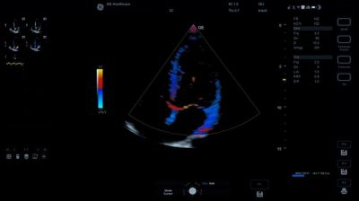 GE Healthcare Versana Premier