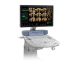 GE Healthcare Voluson S8
