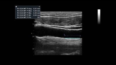 GE Healthcare Vivid T8