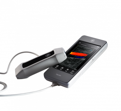 GE Healthcare Vscan
