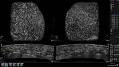 GE Healthcare Invenia Abus