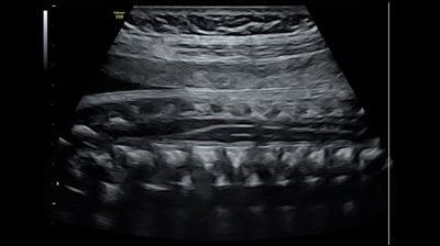 GE Healthcare Voluson S10