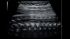 GE Healthcare Voluson S10