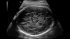 GE Healthcare Voluson S10