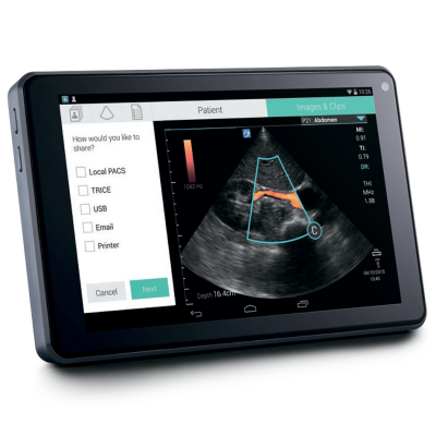 Fujifilm Sonosite iViz