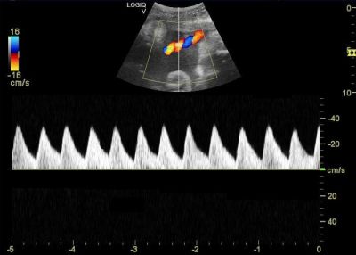 GE Healthcare Logiq V5