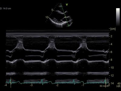 GE Healthcare Vivid S60