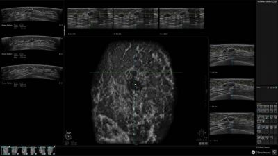 GE Healthcare Invenia Abus