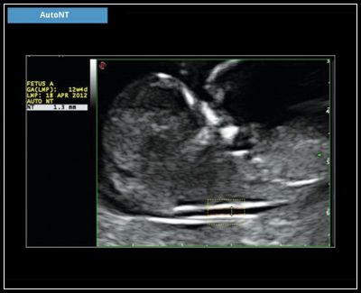 Esaote MyLab x6