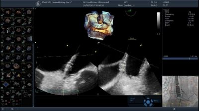 GE Healthcare Vivid S60