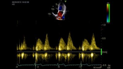 GE Healthcare Vivid IQ