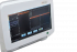 Optovue iScan
