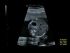 GE Healthcare Voluson S6