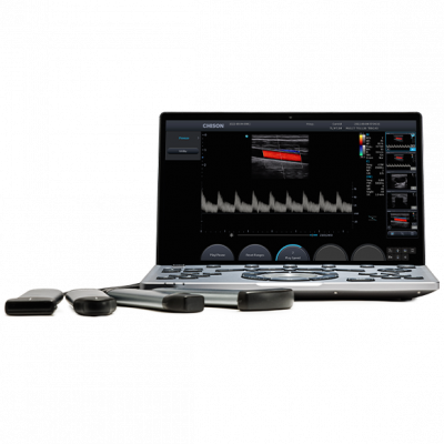 Chison SonoTouch 50 (SonoAir)