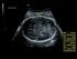 GE Healthcare Voluson S6