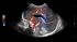 GE Healthcare Logiq E9