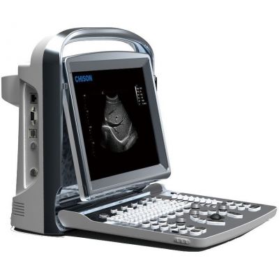 Chison SonoTouch 10