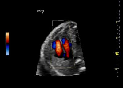 GE Healthcare Logiq F8