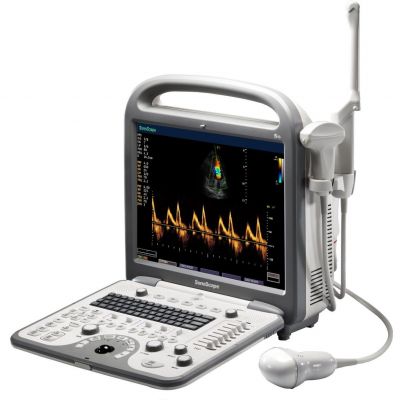Sonoscape S8N
