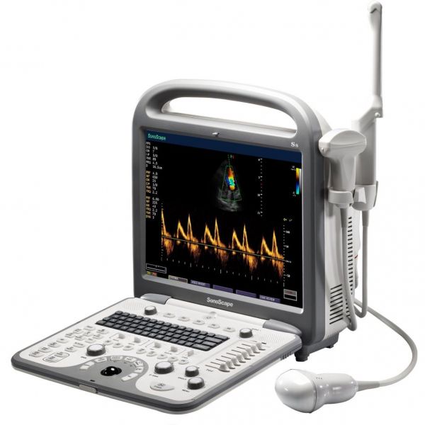 Sonoscape S8N