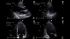 GE Healthcare Vivid T9