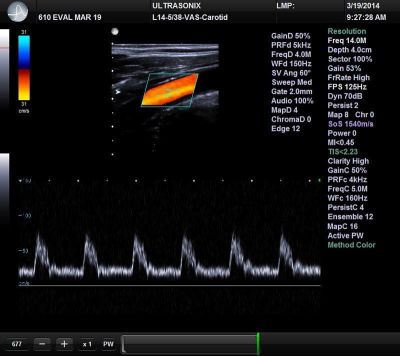 UltraSonix SonixTouch