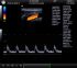 UltraSonix SonixTouch