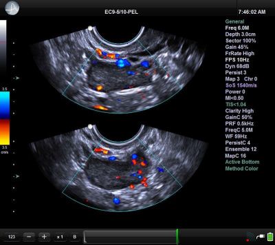 UltraSonix SonixTouch