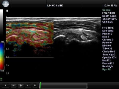 UltraSonix SonixTouch