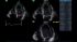 GE Healthcare Vivid IQ