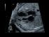 GE Healthcare Voluson S8