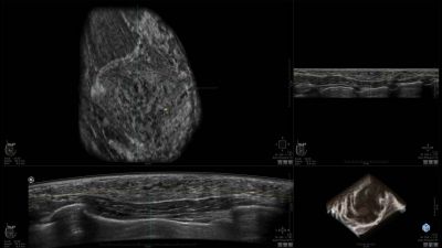 GE Healthcare Invenia Abus