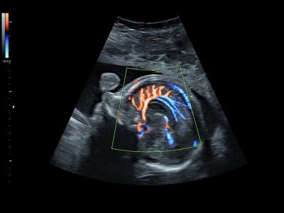 GE Healthcare Voluson S8